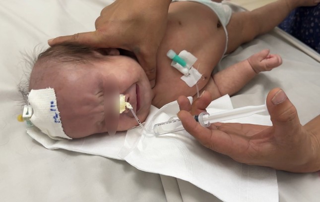 TPHCM: Bé gái 𝟿 ᴛʜáɴɢ ᴛᴜổɪ ᴛử ᴠᴏɴɢ vì tập phục hồi chức năng bởi bác sĩ giả mạo