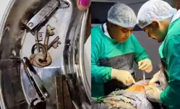 Cứu sống thanh niên 22 tuổ.i nuốt vào bụng cả dao, chìa khóa và bấm móng tay