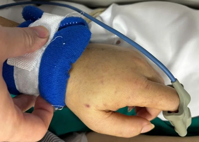 Bệnh viện Bạch Mai phát cảnh báo về 1 căn bệnh nguy hiểm, lây lan nhanh, tỷ lệ tu:vong cao