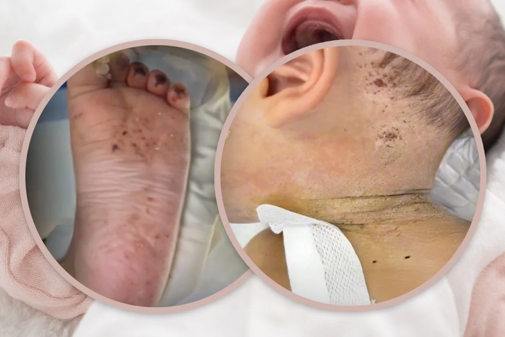 B/é 10 t.háng t/uổi suýt mấ.t m.ạng vì bị mẹ châm kim hàng trăm lần để ‘chữa bệnh’