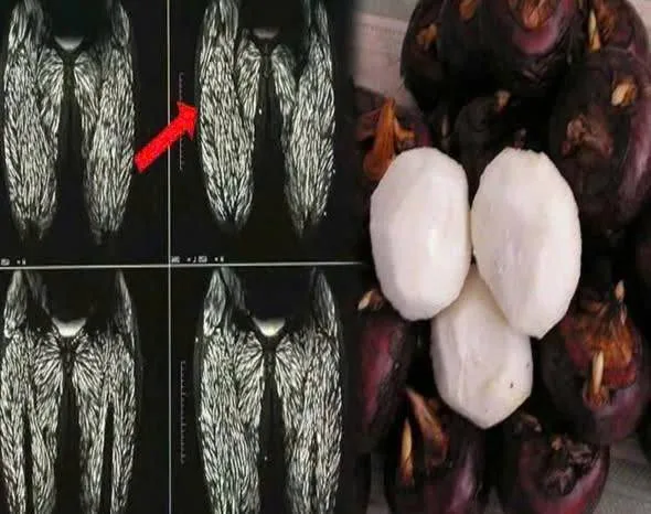 Những loại thực phẩm quen thuộc là ‘ổ chứa vi khuẩn’ khi ăn cần cực kỳ thận trọng