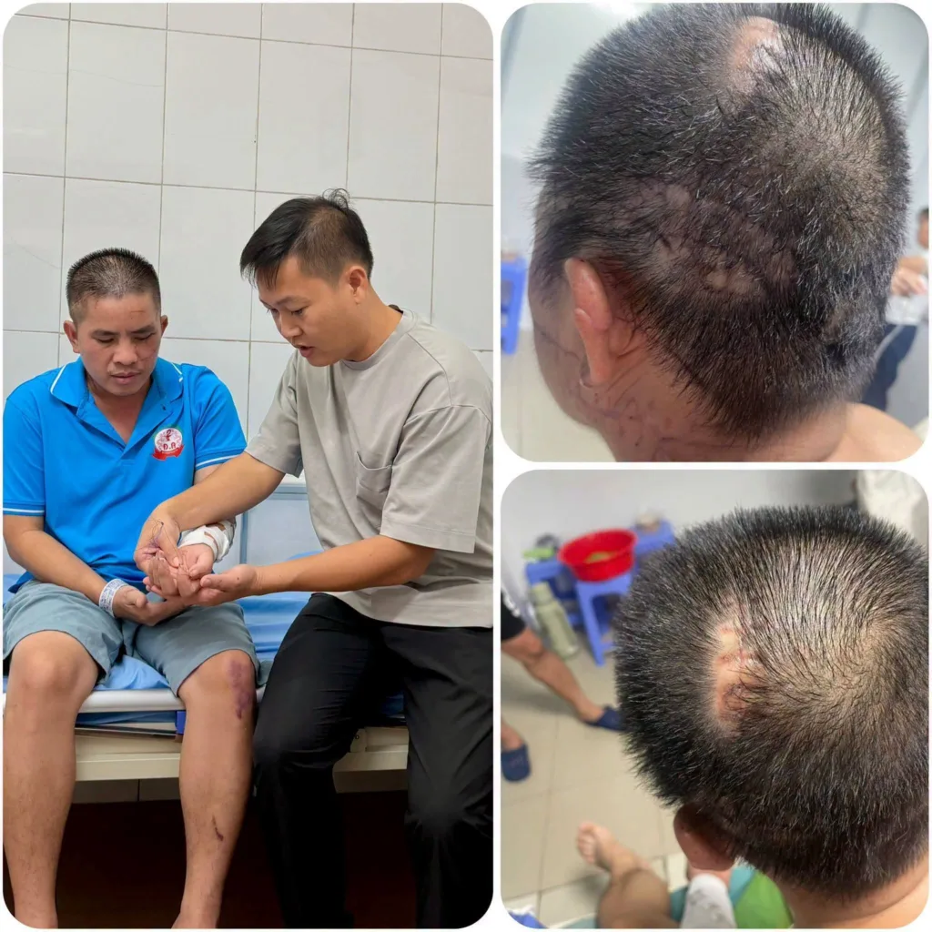 Ấm Lòng: Bất ngờ với số tiền cực lớn được bà con gửi đến anh Quang trong vụ án ở Đồng Nai, gia đình xin dừng nhận hỗ trợ