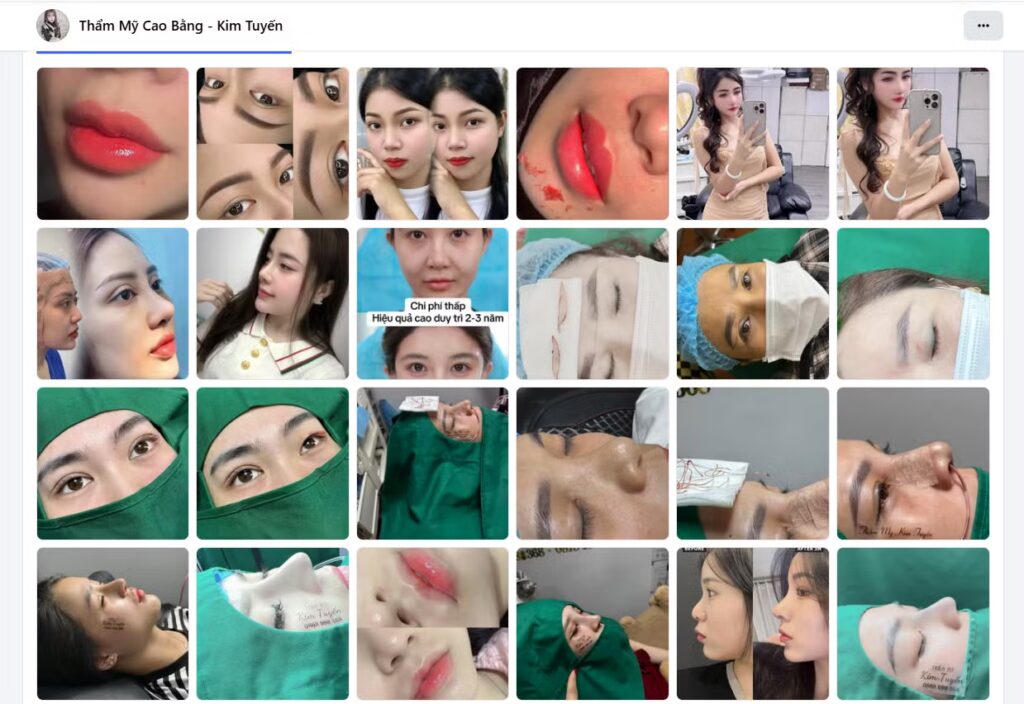 Khởi tố chủ cơ sở phun, xăm,… thẩm mỹ